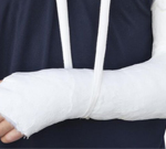 Fracture treatment in Vijayawada