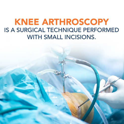 arthroscopy in vijayawada