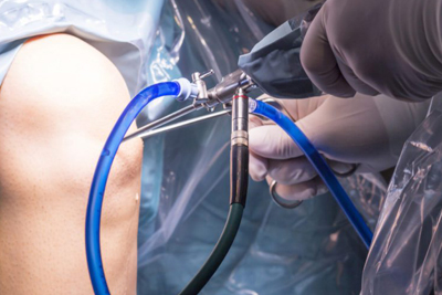 Arthroscopy Surgeons in Vijayawada